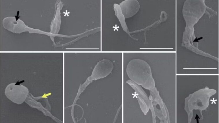 Ce parasite pénètre dans les testicules et décapite les spermatozoïdes : un lien possible avec la chute de la fertilité 1 Spermatozoïdes décapités et déformés par le parasite Toxoplasma gondii. Crédit : Rojas-Barón et al/The FEBS Journal, CC BY-SA