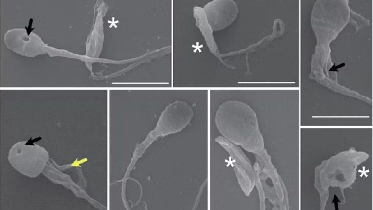Ce parasite pénètre dans les testicules et décapite les spermatozoïdes : un lien possible avec la chute de la fertilité 2 Spermatozoïdes décapités et déformés par le parasite Toxoplasma gondii. Crédit : Rojas-Barón et al/The FEBS Journal, CC BY-SA