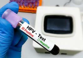 Le premier test à faire chez soi pour le papillomavirus : découvrez comment fonctionne le dispositif approuvé par la FDA 45 Image