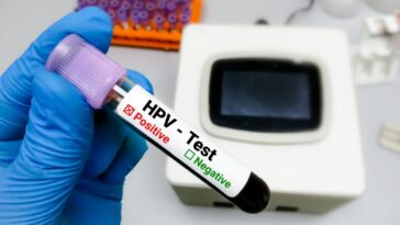 Le premier test à faire chez soi pour le papillomavirus : découvrez comment fonctionne le dispositif approuvé par la FDA 19 Image