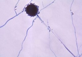 Les champignons mortels se propagent avec le changement climatique : l'alerte des experts 53 L'Aspergillus, un genere di funghi che causa l'aspergillosi / Credit: Wikipedia