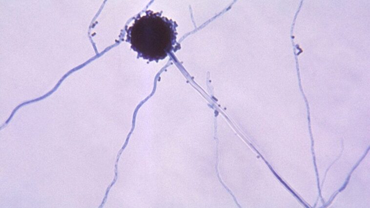 Les champignons mortels se propagent avec le changement climatique : l'alerte des experts 1 L'Aspergillus, un genere di funghi che causa l'aspergillosi / Credit: Wikipedia