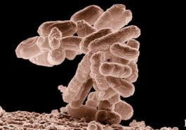 Les microplastiques qui s'accumulent sur les bactéries rendent les microorganismes encore plus menaçants 1 Una colonia di E. coli / Credit: USDA ARS/Wikipedia