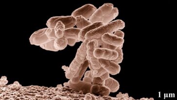 Les microplastiques qui s'accumulent sur les bactéries rendent les microorganismes encore plus menaçants 4 Una colonia di E. coli / Credit: USDA ARS/Wikipedia