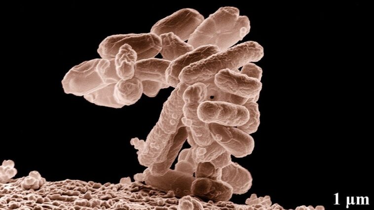 Les microplastiques qui s'accumulent sur les bactéries rendent les microorganismes encore plus menaçants 1 Una colonia di E. coli / Credit: USDA ARS/Wikipedia