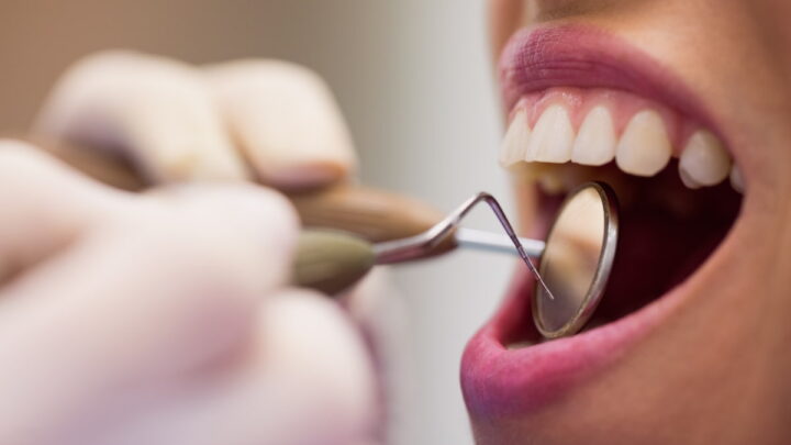 Pour la première fois, des scientifiques réussissent à créer des dents en laboratoire ! 2 Personne montrant ses dents à un dentiste