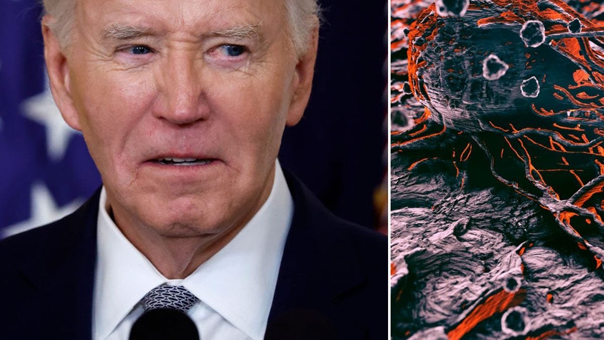 Quels sont les symptômes du cancer de la prostate de Joe Biden : les signes avant-coureurs du diagnostic 2 Joe Biden, 82 ans, a découvert d'avoir un cancer de la prostate avec métastases osseuses après avoir remarqué un accroissement des symptômes urinaires