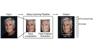Un nouvel outil d'intelligence artificielle détermine l'âge biologique à partir d'une photo 4 Lo strumento FaceAge in azione. / Credit: Mass General Brigham
