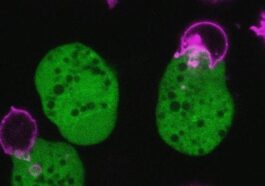 Un parasite se déguise avec des cellules humaines pour échapper à la détection : il tue 70 000 personnes chaque année 28 L'ameba Entamoeba histolytica (vert) attaque les lymphocytes T humains. Crédit : Katherine Ralston, UC Davis