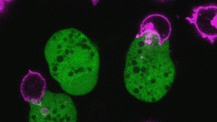 Un parasite se déguise avec des cellules humaines pour échapper à la détection : il tue 70 000 personnes chaque année 1 L'ameba Entamoeba histolytica (vert) attaque les lymphocytes T humains. Crédit : Katherine Ralston, UC Davis