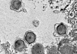 UNIVERSITÉ DE MIAMI | Une infection virale géante de l'algue unicellulaire Florenciella