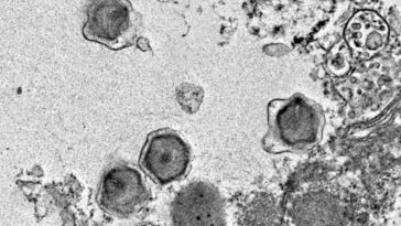 Découverte de 230 virus géants dans les océans : leur ADN révèle comment ils infectent leurs hôtes 13 UNIVERSITÉ DE MIAMI | Une infection virale géante de l'algue unicellulaire Florenciella