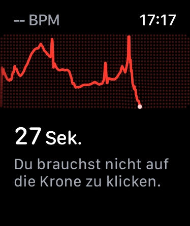 Ces 10 fonctionnalités méconnues de ton Apple Watch vont te surprendre ! 10 Écrire un ECG Apple Watch