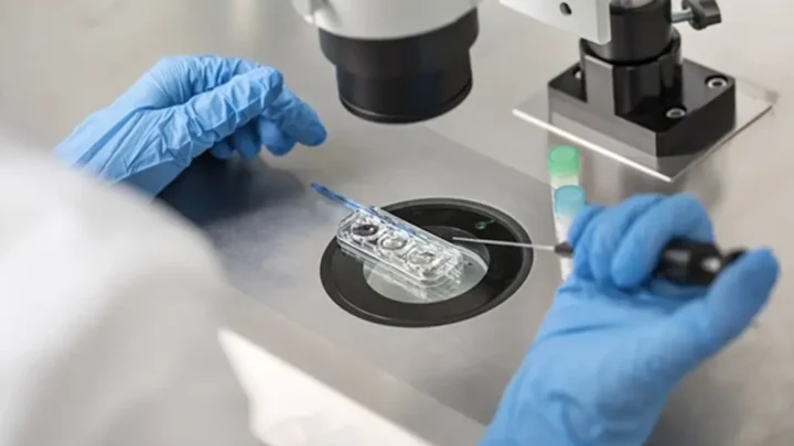 Une IA détecte 3 spermatozoïdes et rend possible une grossesse après 18 ans d'infertilité 3 1753569742 767 Une IA detecte 3 spermatozoides et rend possible une grossesse.webp