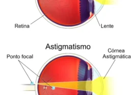 40% des gens ont des yeux qui ne sont pas parfaitement ronds. Sais-tu pourquoi ? 50 40% des gens ont des yeux qui ne sont pas parfaitement ronds. Sais-tu pourquoi ?