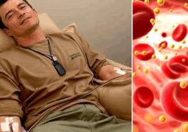 Le soin d’Orlando Bloom pour éliminer les microplastiques du sang suscite l'inquiétude des experts 35 L’acteur britannique Orlando Bloom s’est soumis à une aferèse pour tenter d’éliminer les microplastiques de son sang