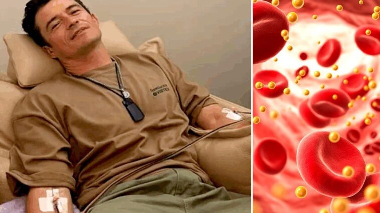 Le soin d’Orlando Bloom pour éliminer les microplastiques du sang suscite l'inquiétude des experts 1 L’acteur britannique Orlando Bloom s’est soumis à une aferèse pour tenter d’éliminer les microplastiques de son sang