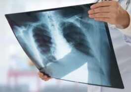 L'ère dorée des traitements : de nombreux cancers ne sont plus une "sentence de mort" 21 L'ère dorée des traitements : de nombreux cancers ne sont plus une "sentence de mort"