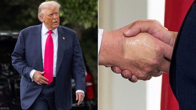 Pourquoi la Maison Blanche explique que Trump avait la main couverte de fond de teint 1 Image