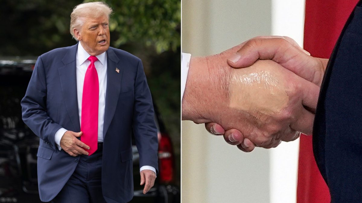Pourquoi la Maison Blanche explique que Trump avait la main couverte de fond de teint 2 Image