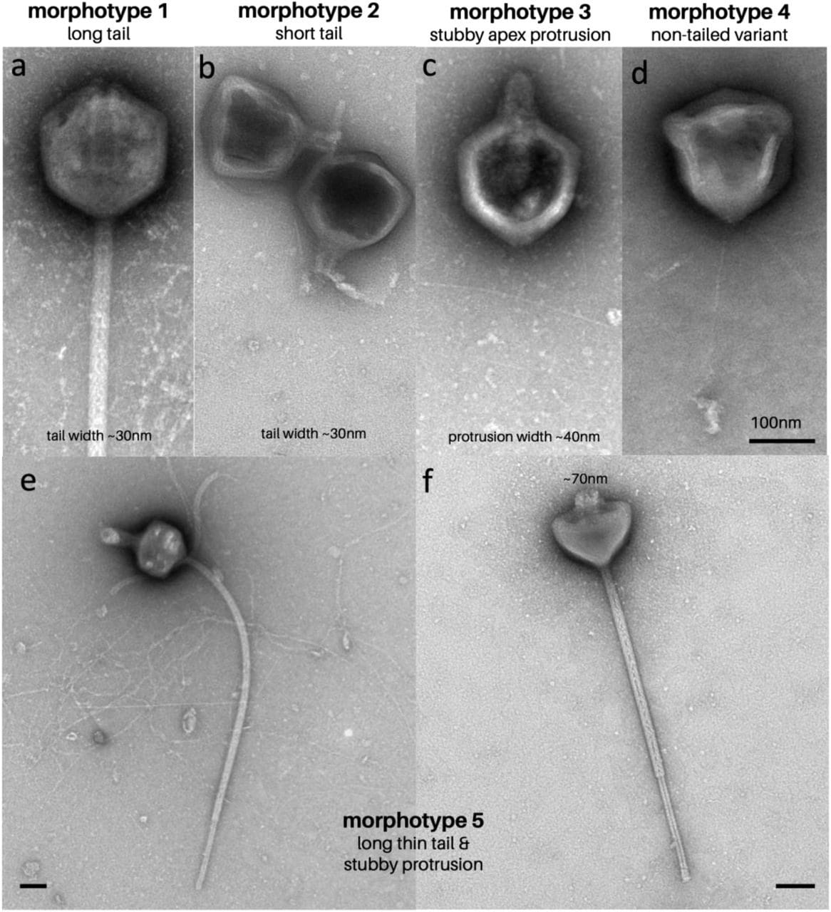 Découverte d'un mystérieux virus géant à la queue exceptionnelle : tout ce que nous savons sur PelV-1 3 Particules virales de PelV–1. Crédit : Gajigan et al / bioRxiv