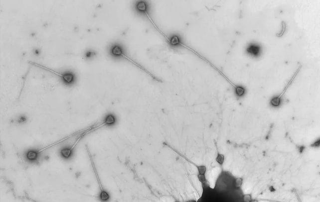 Découverte d'un mystérieux virus géant à la queue exceptionnelle : tout ce que nous savons sur PelV-1 4 Particules virales de PelV–1. Crédit : Gajigan et al / bioRxiv