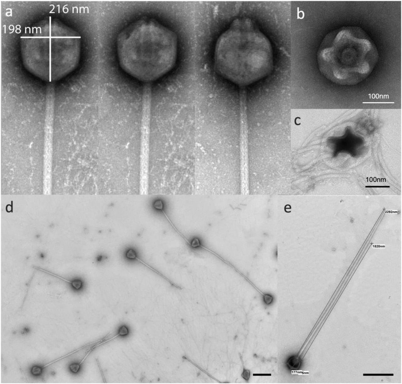 Découverte d'un mystérieux virus géant à la queue exceptionnelle : tout ce que nous savons sur PelV-1 5 Particules virales de PelV–1. Crédit : Gajigan et al / bioRxiv