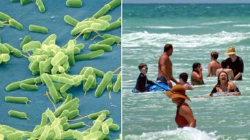 Bactérie mangeuse de chair : 10 morts aux États-Unis après contact avec l'eau de mer ou des mollusques crus 19 Bactérie 'mange-carne' Vibrio vulnificus cause 10 morts le long de la côte atlantique des États-Unis