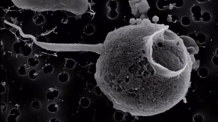 Découverte d'un mystérieux virus géant à la queue exceptionnelle : tout ce que nous savons sur PelV-1 1 Le virus PelV–1. Crédit : Gajigan et al / bioRxiv