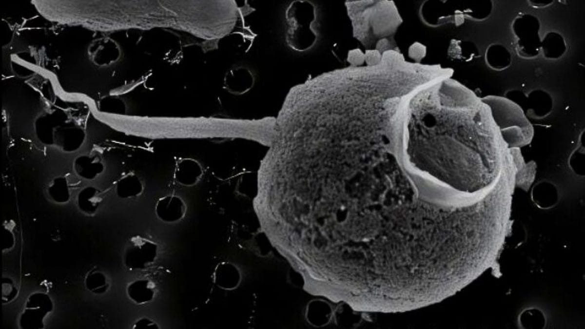 Découverte d'un mystérieux virus géant à la queue exceptionnelle : tout ce que nous savons sur PelV-1 2 Le virus PelV–1. Crédit : Gajigan et al / bioRxiv