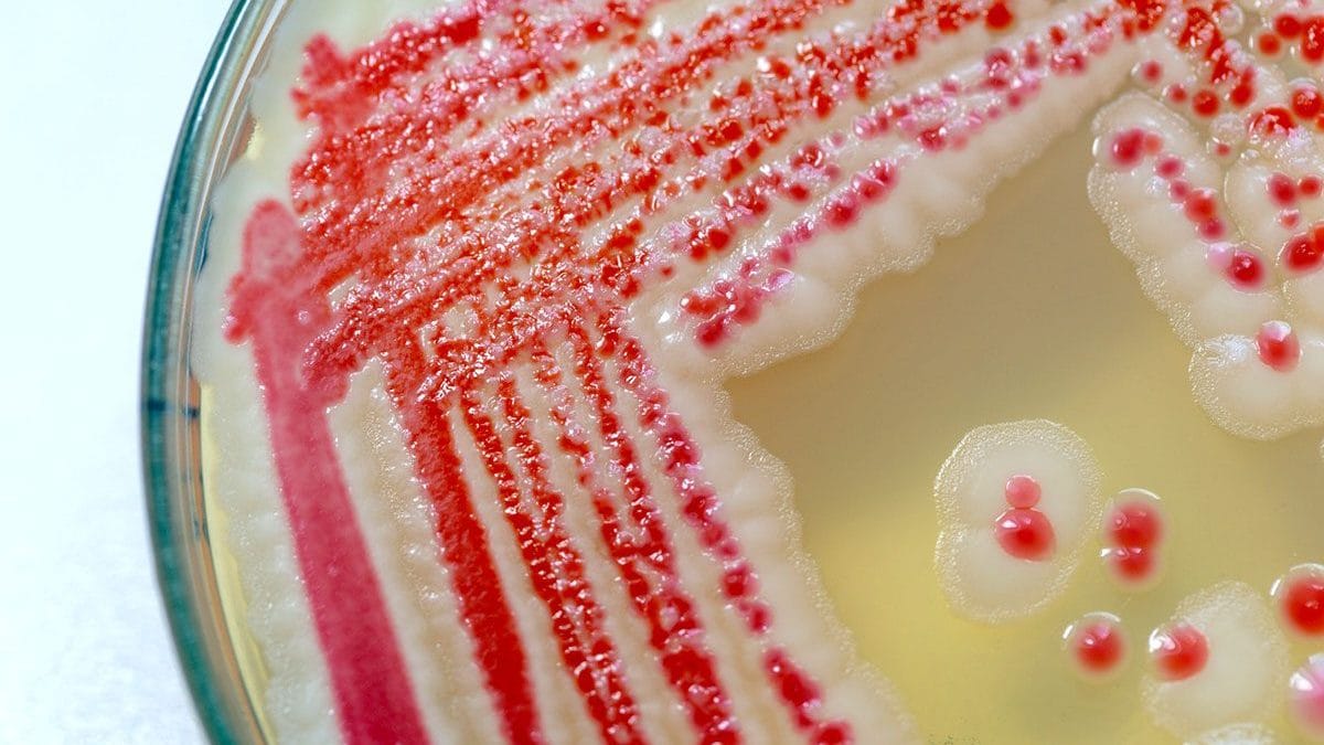 Des nouveau-nés décédés à Bolzano suite à une infection par le bacille Serratia : qu'est-ce que c'est et pourquoi frappe-t-il les plus vulnérables ? 2 Colonie de bactéries Serratia marcescens sur plaque