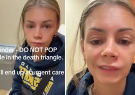 Lish Marie a fini à l'hôpital pour avoir pressé un bouton sur le visage / Crédit : TikTok/@lishmarie1