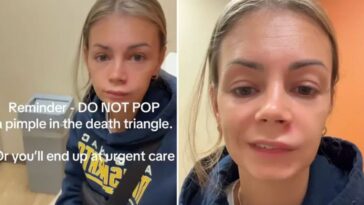 Écraser un bouton sur le visage et finir à l'hôpital : l'erreur qui aurait pu lui coûter la vie 16 Lish Marie a fini à l'hôpital pour avoir pressé un bouton sur le visage / Crédit : TikTok/@lishmarie1