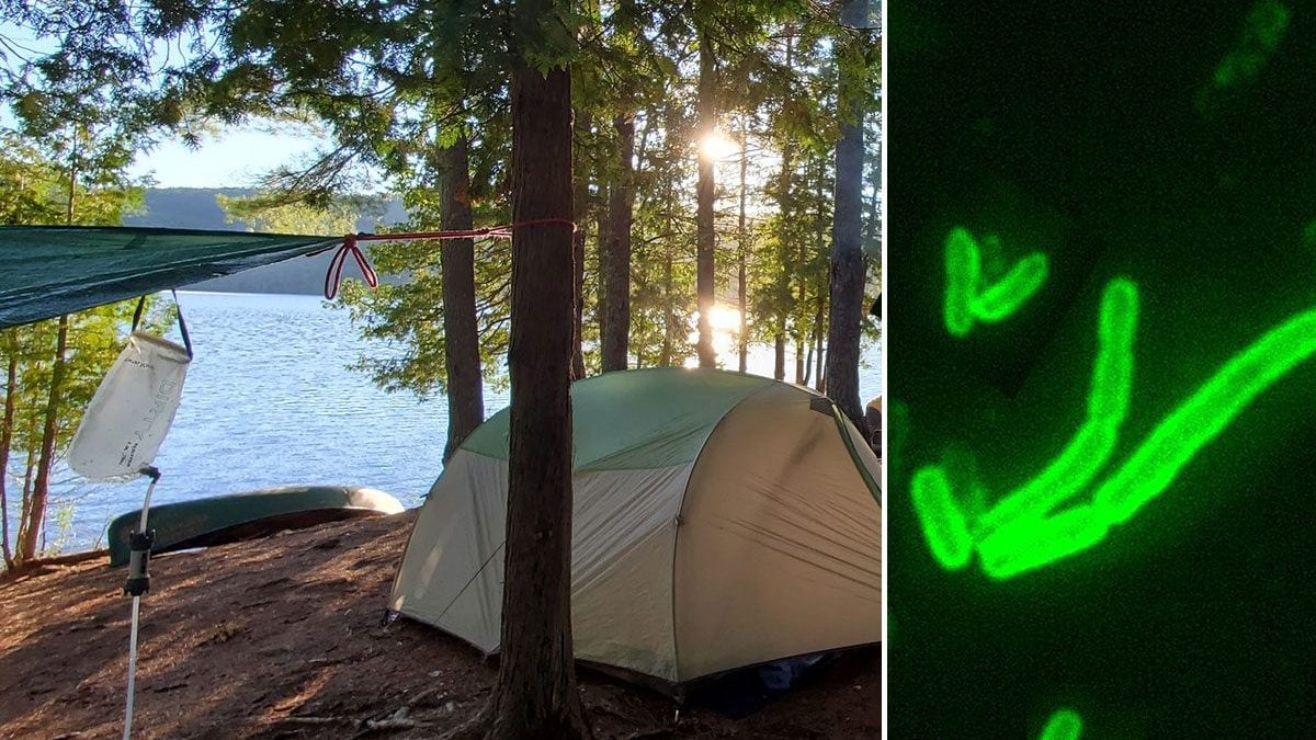 Homme positif au Covid-19 en Californie, en vacances dans un camping au bord du lac Tahoe 2 En Californie, un homme a été testé positif à la peste après avoir séjourné dans un camping près du lac Tahoe. À droite, Yersinia pestis, la bactérie responsable de la maladie / Crédit : iStock/Wikipedia