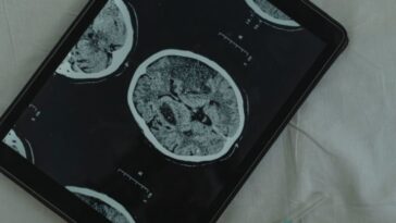 Le cerveau a vieilli rapidement pendant la pandémie. Et ce n'était pas uniquement à cause du virus… 22 Le cerveau a vieilli rapidement pendant la pandémie. Et ce n'était pas uniquement à cause du virus…