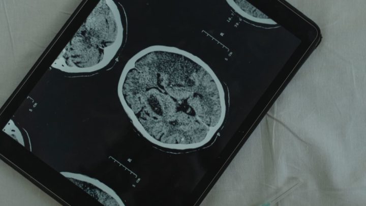 Le cerveau a vieilli rapidement pendant la pandémie. Et ce n'était pas uniquement à cause du virus… 1 Le cerveau a vieilli rapidement pendant la pandémie. Et ce n'était pas uniquement à cause du virus…