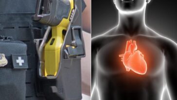 Les dangers du taser pour le cœur : le cardiologue explique "C'est comme un crampe dans tout le corps" 27 Image