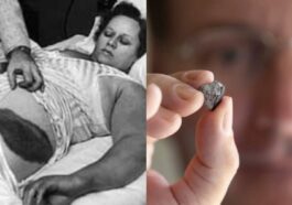 L'incroyable histoire d'un homme touché par un météore : un événement rarissime à jamais gravé dans l'histoire 15 Image