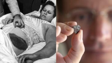 L'incroyable histoire d'un homme touché par un météore : un événement rarissime à jamais gravé dans l'histoire 24 Image