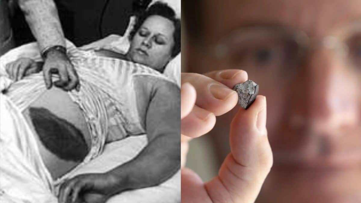 L'incroyable histoire d'un homme touché par un météore : un événement rarissime à jamais gravé dans l'histoire 2 Image