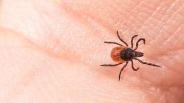 Tout savoir sur la maladie de Lyme : symptômes et causes de l'infection transmise par les tiques 14 Image
