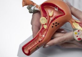 Un dispositif en forme de bretzel guérit 82% des patients de leurs tumeurs