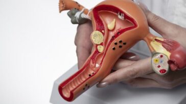 Un dispositif en forme de bretzel guérit 82% des patients de leurs tumeurs 30 Un dispositif en forme de bretzel guérit 82% des patients de leurs tumeurs