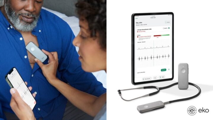 L'IA arrive dans les stéthoscopes et détecte les maladies cardiaques graves en seulement 15 secondes 5 Estetoscópio com IA da Eko Health