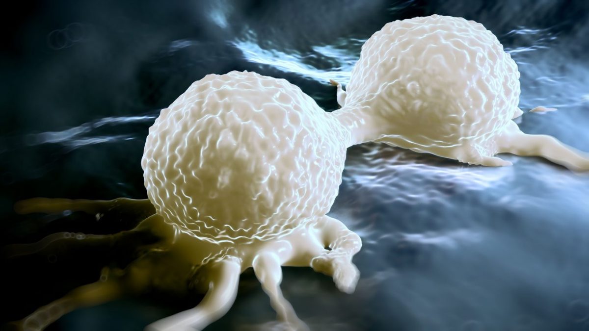 Cancer et mortalité en hausse : selon une étude parue dans The Lancet, 40 % des cas sont attribuables à des causes évitables 2 Image