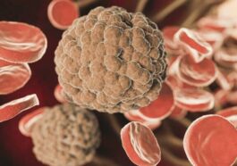 Finalement, les œufs peuvent-ils vraiment aider à réduire le mauvais cholestérol ?