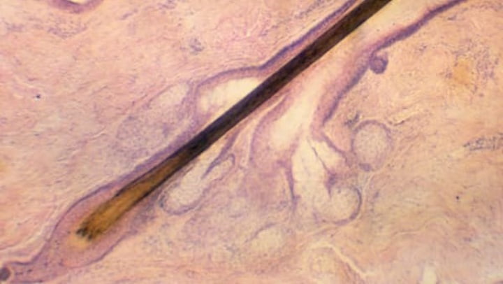 Des cheveux blancs : une défense naturelle contre le cancer, selon une étude 3 Follicule pileux, une structure complexe située dans le derme, responsable de la production et de la croissance des cheveux.