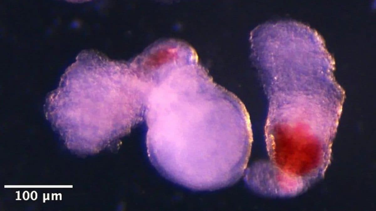 Créez des modèles d'embryons humains avec des cellules cardiaques battantes et producteurs de sang : quelle est leur utilité ? 2 Deux érythroïdes avec le sang rouge bien visible à l'œil nu. Crédit : Université de Cambridge