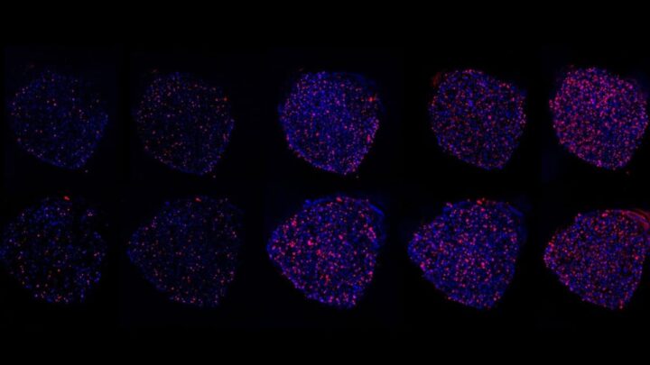 Cultiver des tumeurs dans l'espace pour personnaliser le traitement du cancer 3 Cultiver des tumeurs dans lespace pour personnaliser le traitement du