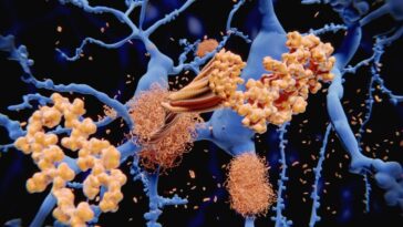 Le signal caché qui déclenche Alzheimer : la découverte des chercheurs sur la formation des plaques 18 Un signal cellulaire peut induire l'agrégation de peptides de bêta-amiloïde (en jaune) dans le cerveau, accélérant la formation de plaques amyloïdes typiques de l'Alzheimer / Crédit : iStock